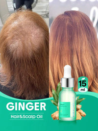 Ginger